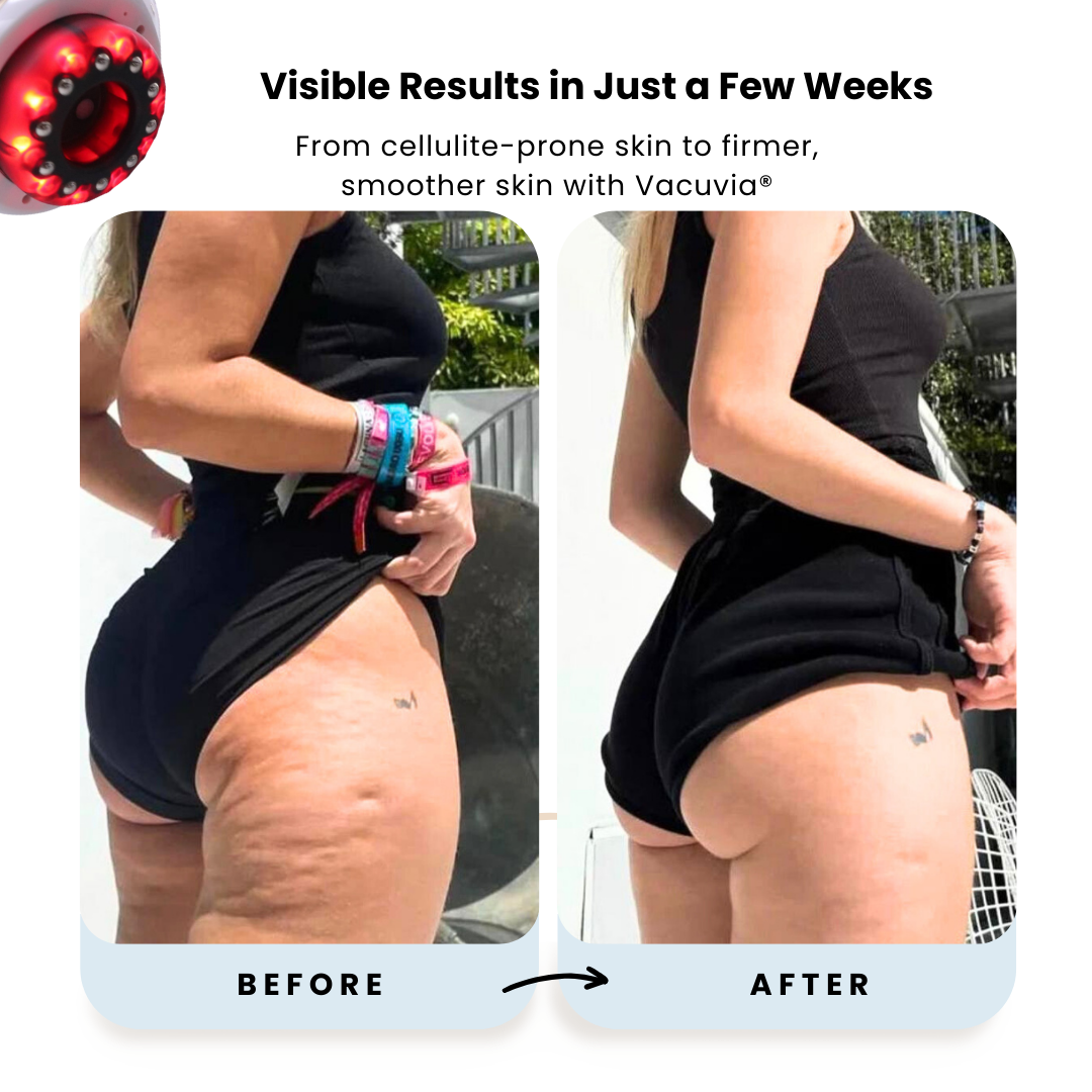 FluidSculpt™ – Firmer, More Toned Skin